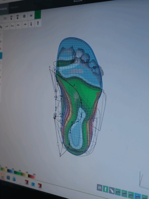 3D-Fußscan in der Werkstatt Adelmann