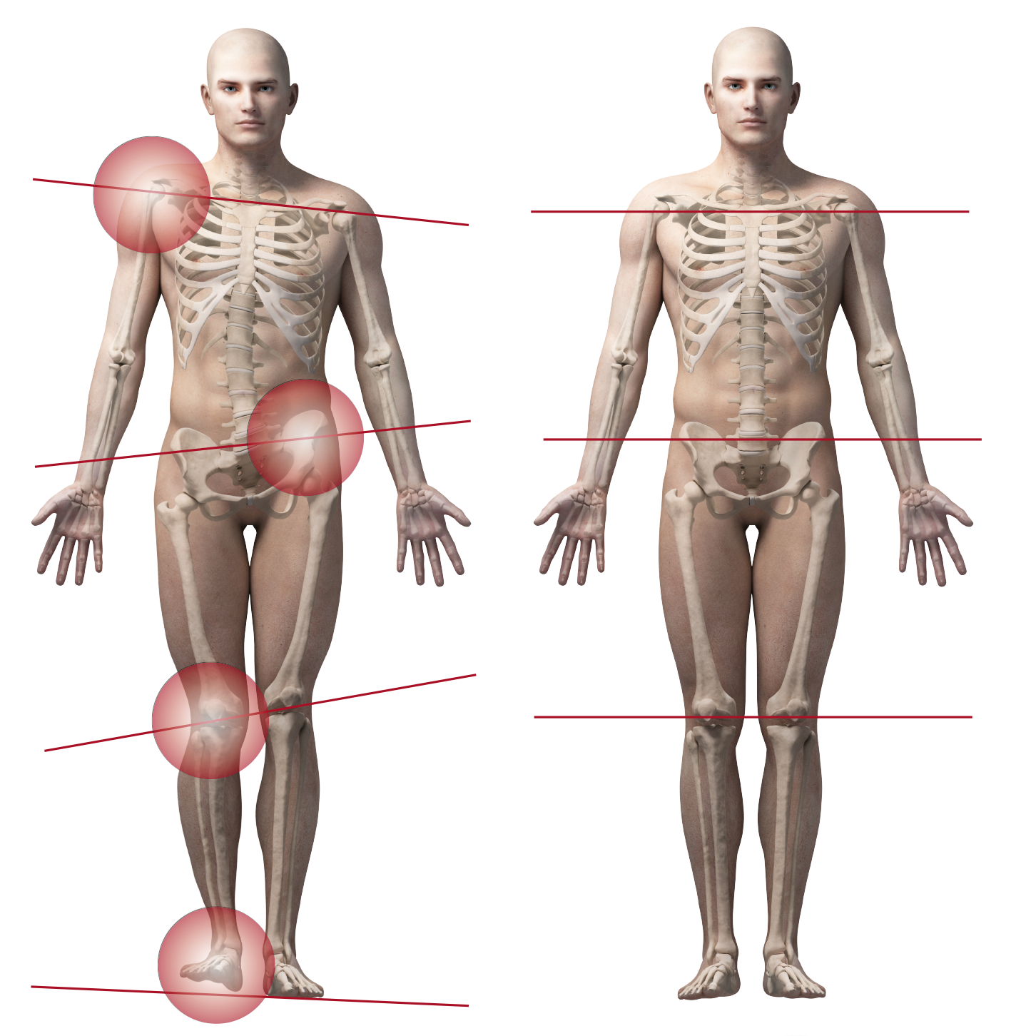 Vorher-Nachher-Vergleich: Wirkung orthopädischer Einlagen auf die Körperstatik